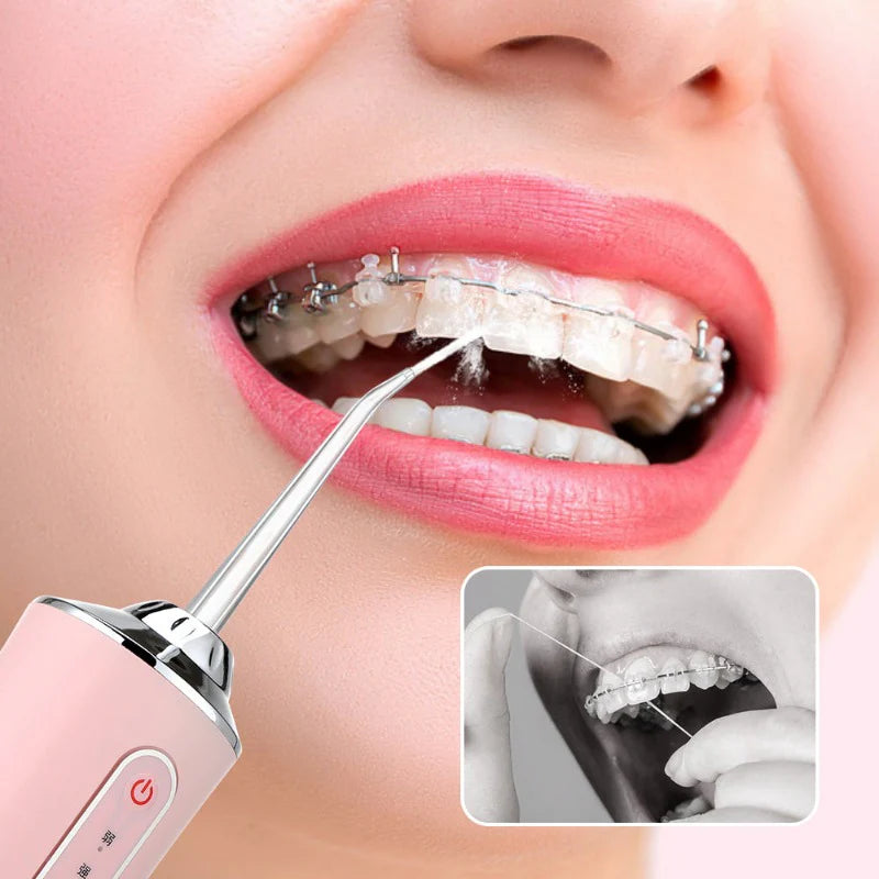 50% OFF SOLO POR HOY: Clean Brackets® - Irrigador Bucal