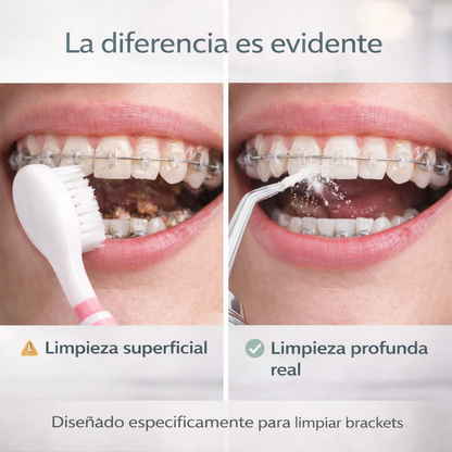 Clean Brackets® - Irrigador Bucal para limpiar tus brackets